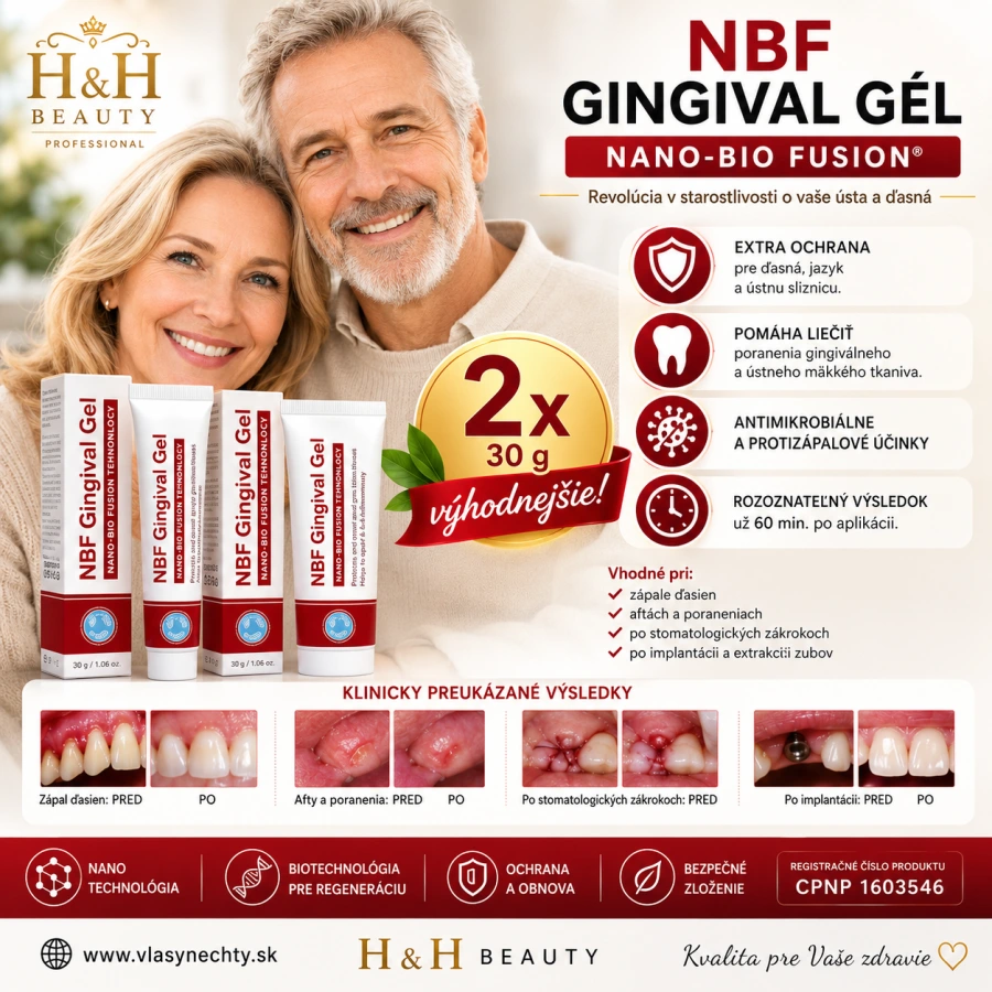 NBF GINGIVAL GÉL 2x30 g - NA RANY, POPÁLENINY, HERPES, ĎASNÁ / 13 EUR KUS/