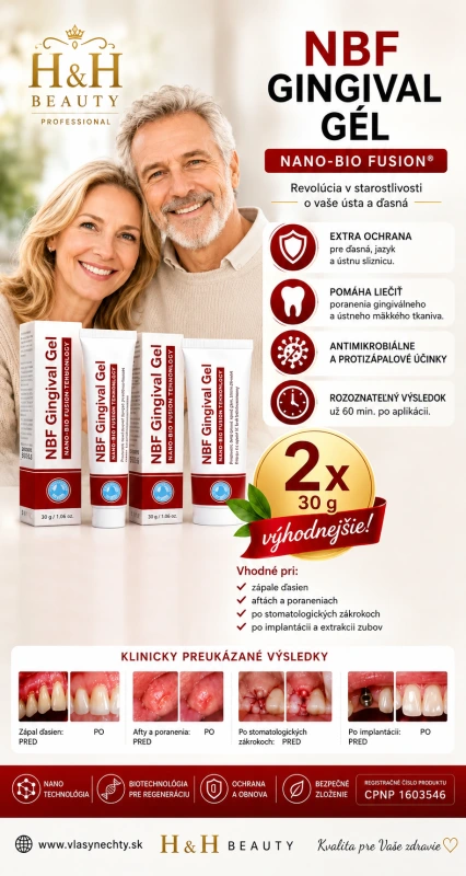 NBF GINGIVAL GÉL 2x30 g - NA RANY, POPÁLENINY, HERPES, ĎASNÁ / 13 EUR KUS/ 6