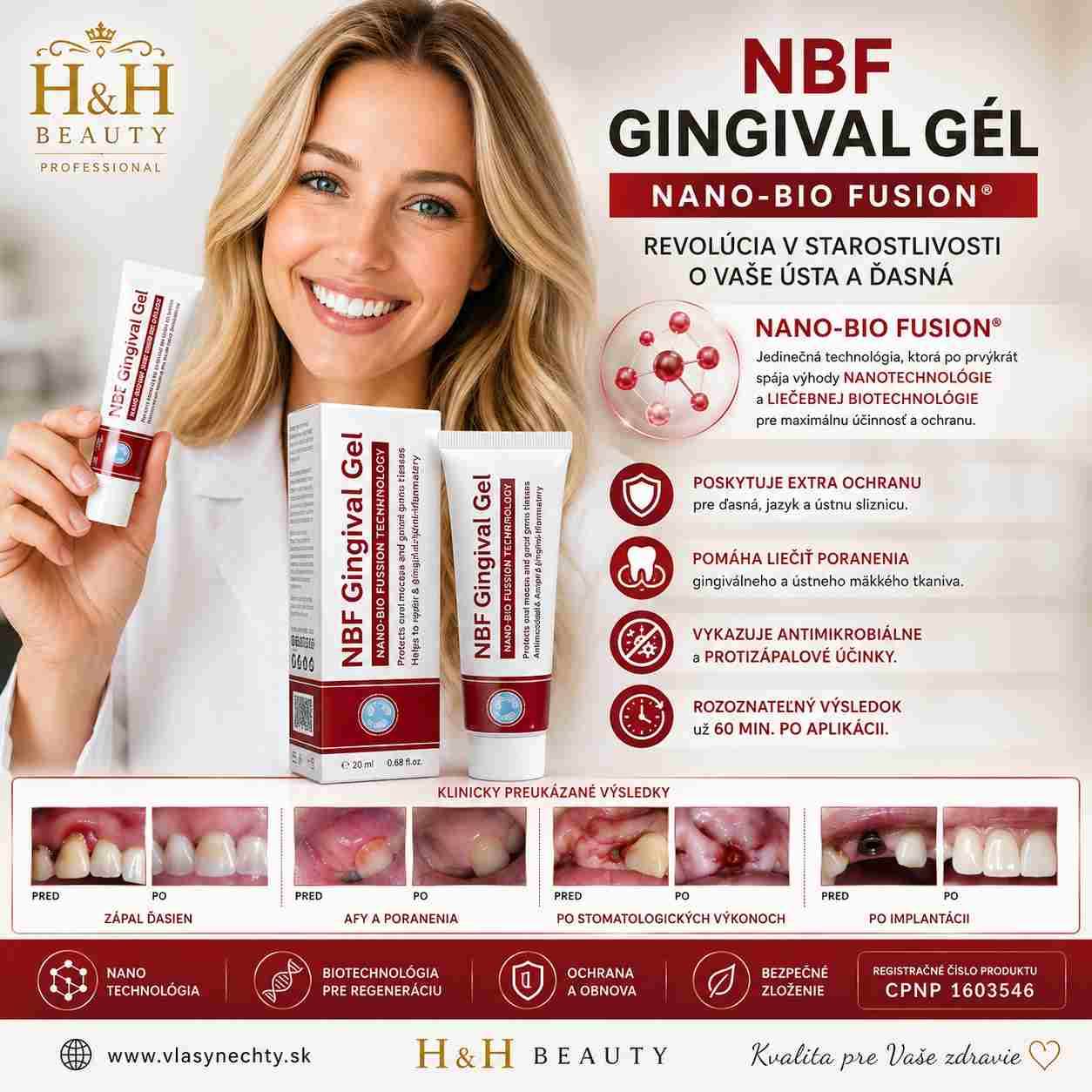 NBF GINGIVAL GÉL